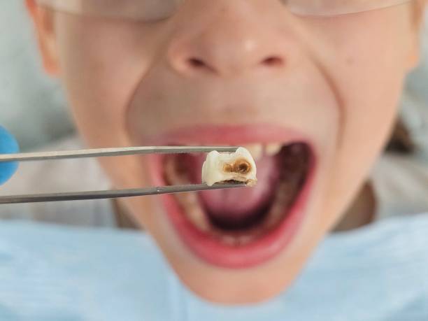 Best Affordable Emergency Dental Care  in Central High, OK